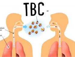 Dinkes Sebut Penderita TBC di Sampang Masih Tinggi