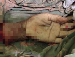 Marbani Dianiaya Tetangga, Tangan Kiri Putus, Polisi: Tersangka dalam Pengejaran