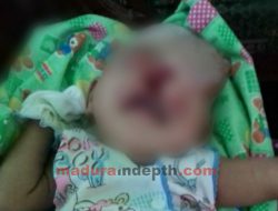 Lahir Dengan Wajah Tak Normal, Mohammad Ali Harus Jalani Operasi Plastik