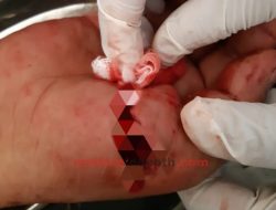 Abdus Salam Warga Sumenep Dibacok Tetangga, Pelaku Dikejar Polisi