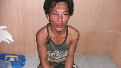 Modus Jadi Tukang Pijat