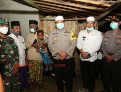 Bupati Sampang Bantu Biaya Operasi Bocah Tak Beranus