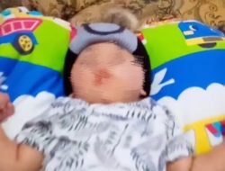 Bayi Dhanefs Meninggal, Pengidap Sindrom Putri Tidur