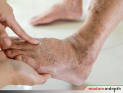 Gejala Diabetes, Cara Pencegahan, dan Penanganan yang Tepat bagi Penderita